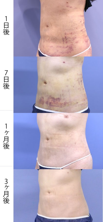 斜め