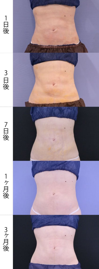 正面