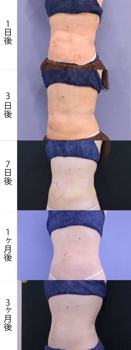 斜め