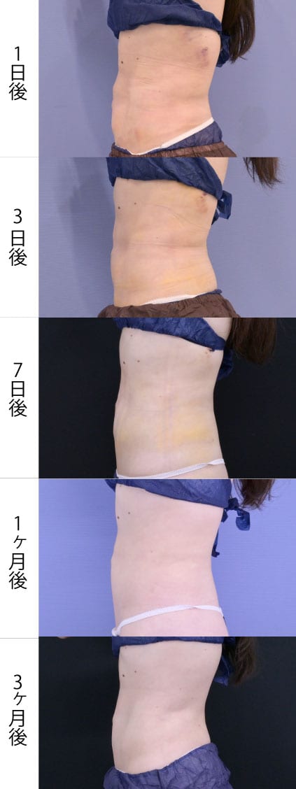 横