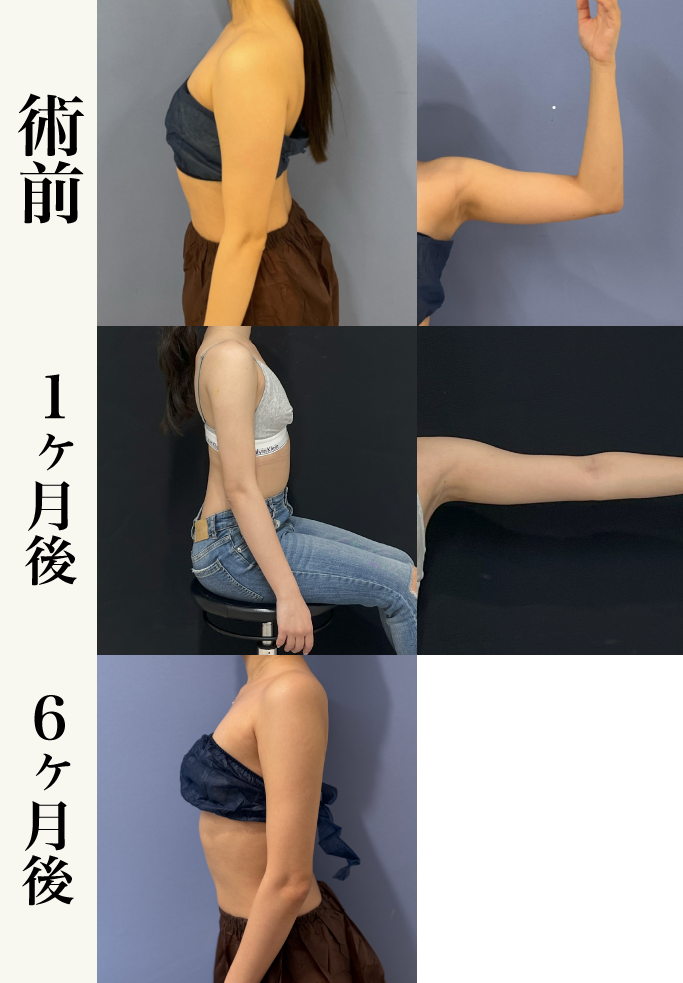 症例写真