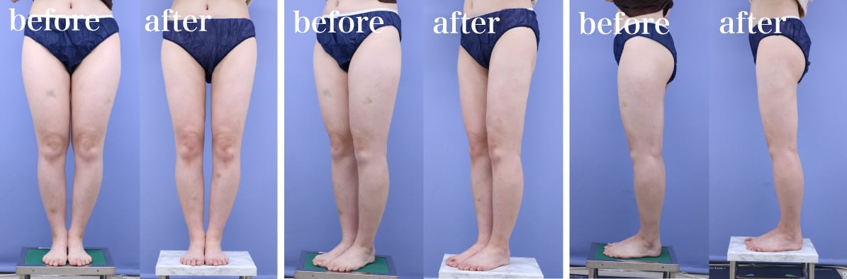 before/after