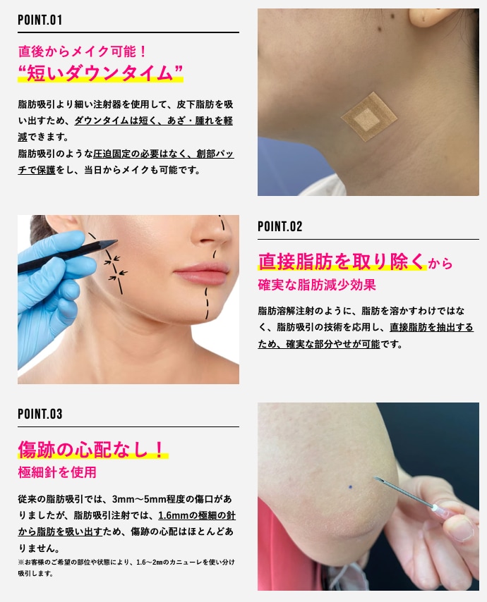脂肪を「直接取り出す」からリバウンドしにくい！