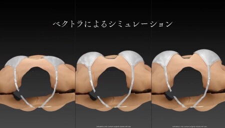 ベクトラで何ができるのか？