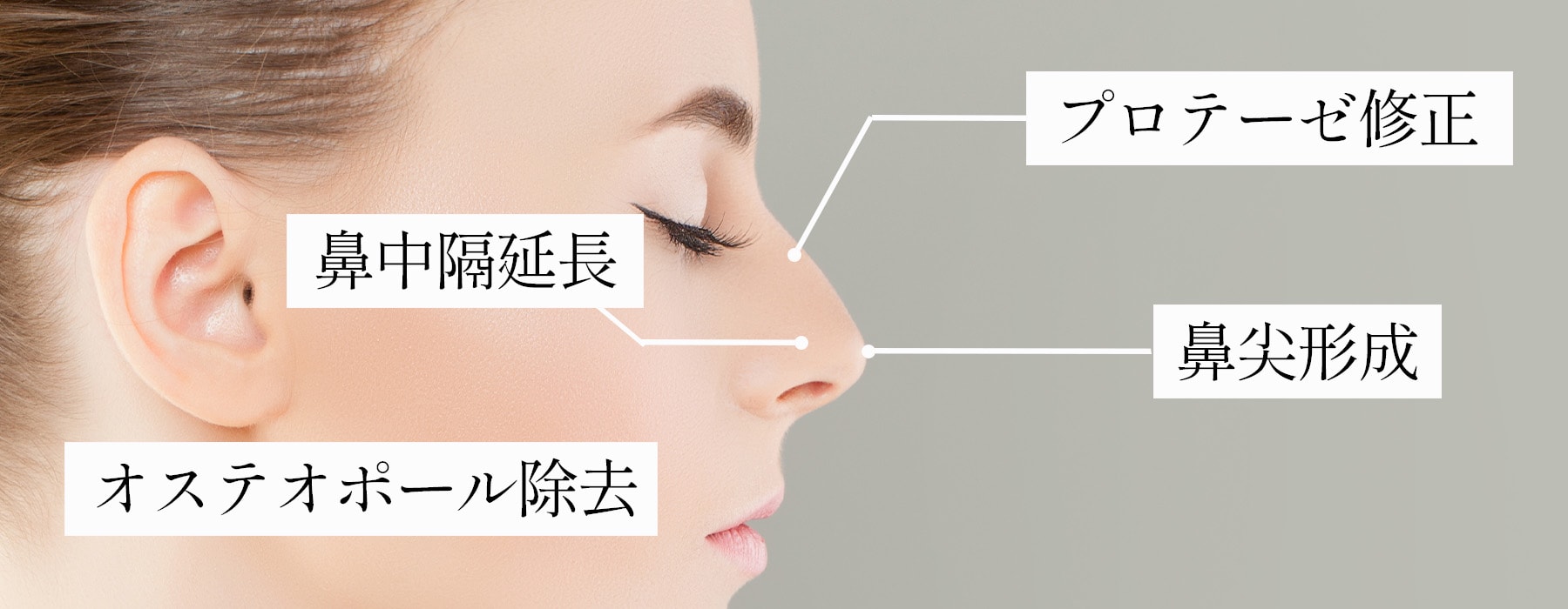 修正の主な方法～症状に応じて適切な施術が選択されます～
