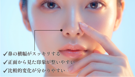 小鼻縮小のメリット