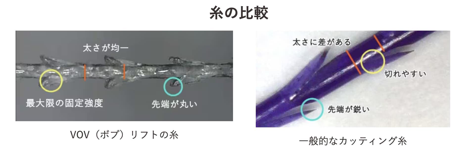 🥈強度が高くしなやかさが特徴の『VOVリフト』