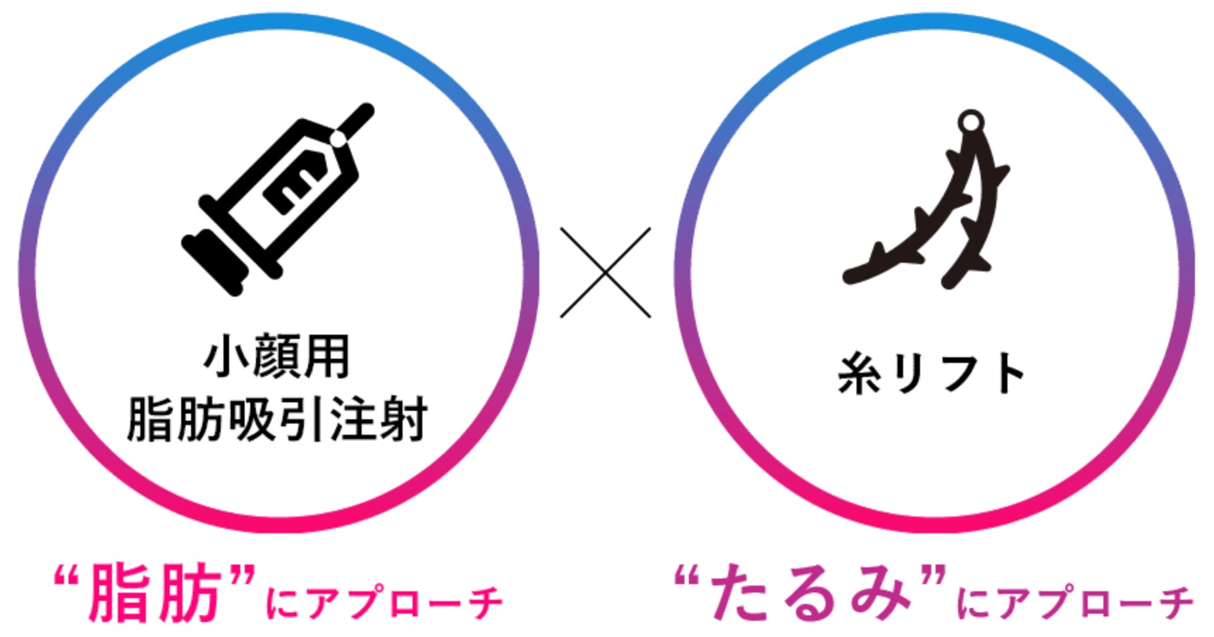 もっと小顔に！『糸＋脂肪吸引注射』