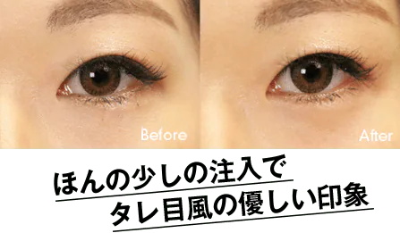涙袋爆誕でウルウル愛されEye