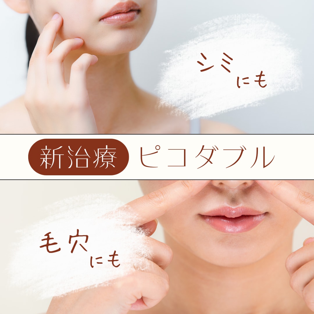 シミと毛穴を同時に改善❗️新治療『ピコダブル』は諦めていた肌悩みの救世主💪
