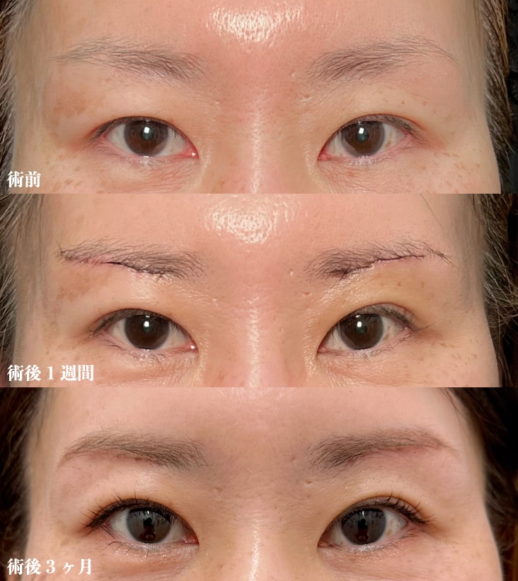 40代女性