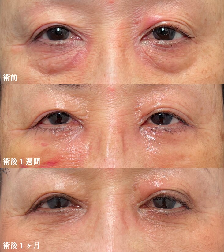 60代女性
