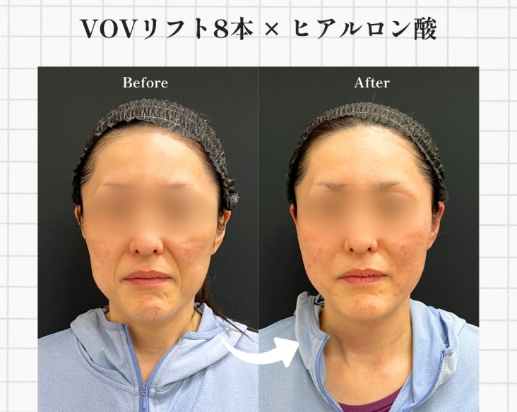 ふと鏡を見て「老けたかも」と感じたことはありませんか？
