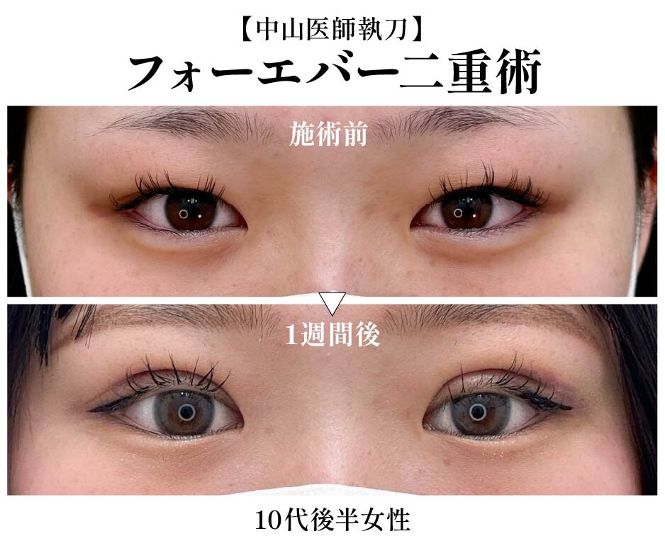 【中山 翔也医師】フォーエバー二重術が大得意✨静岡院在籍医師