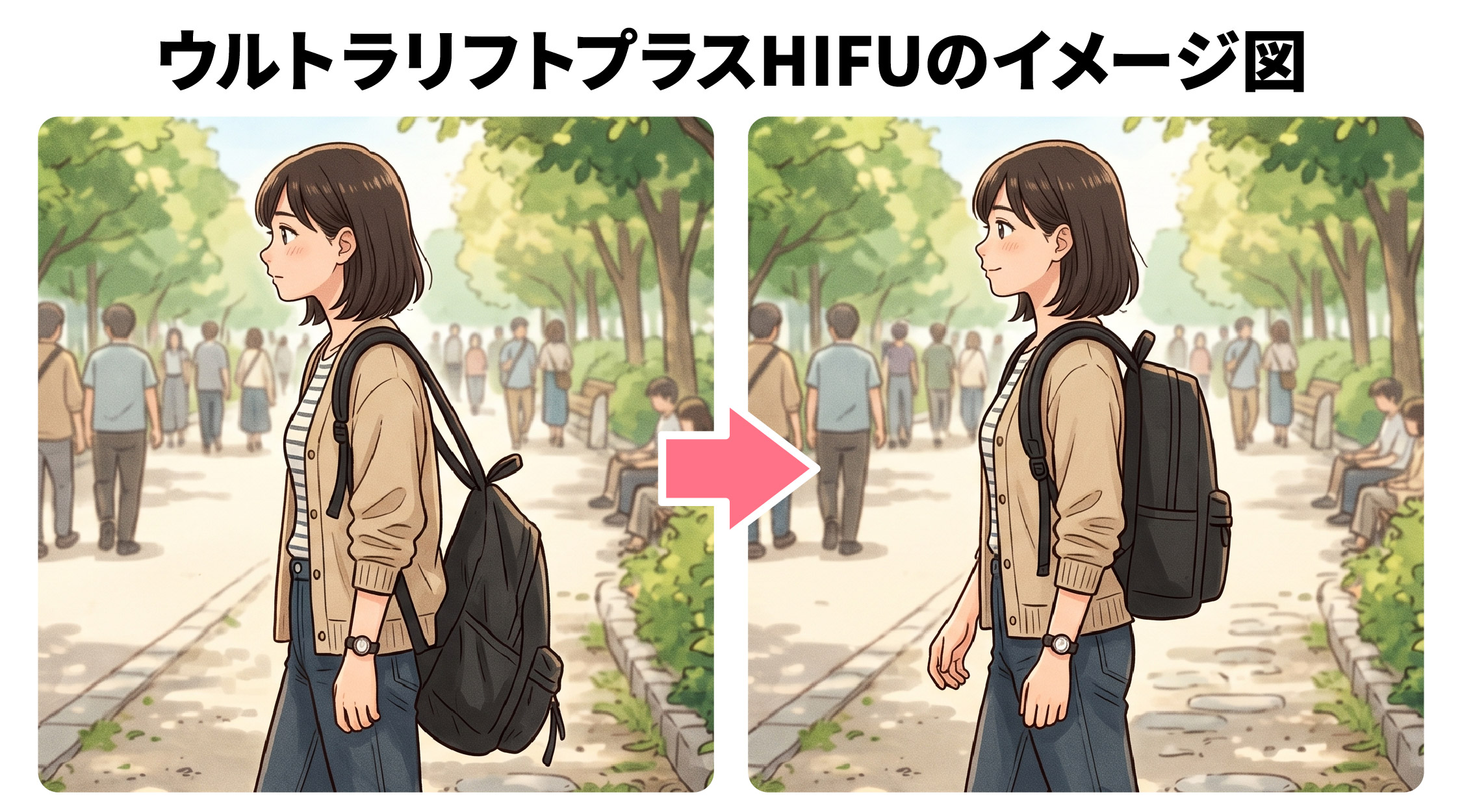ウルトラリフトプラスHIFU（ハイフ）とデンシティの<br />
それぞれのイメージ図