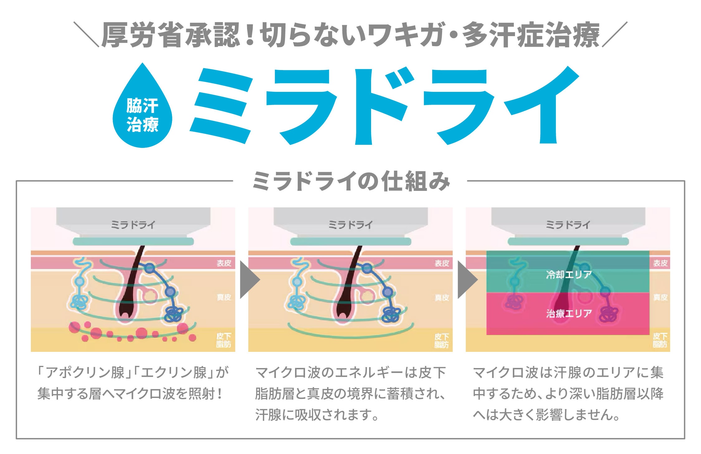 ミラドライ