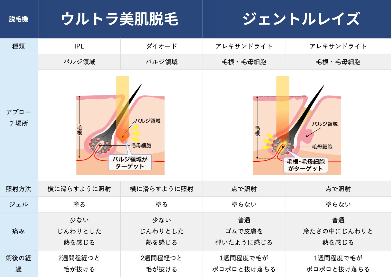 頑固な毛でもしっかり脱毛<br />
お客様のご希望に合わせて脱毛機選択可能