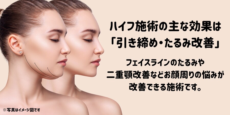 ハイフ施術の主な効果は<br />
「引き締め・たるみ改善」