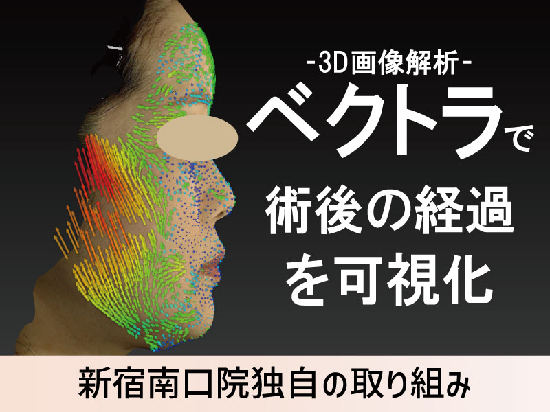 新宿で術後の変化が“見える”美容医療 《SBC新宿南口院のベクトラ撮影》とは？