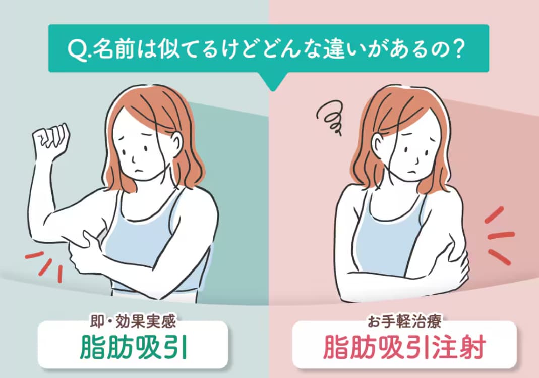 美ボディ脂肪吸引と脂肪吸引注射の違い