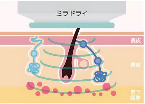 仕組み1