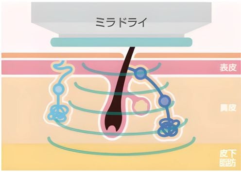 仕組み2
