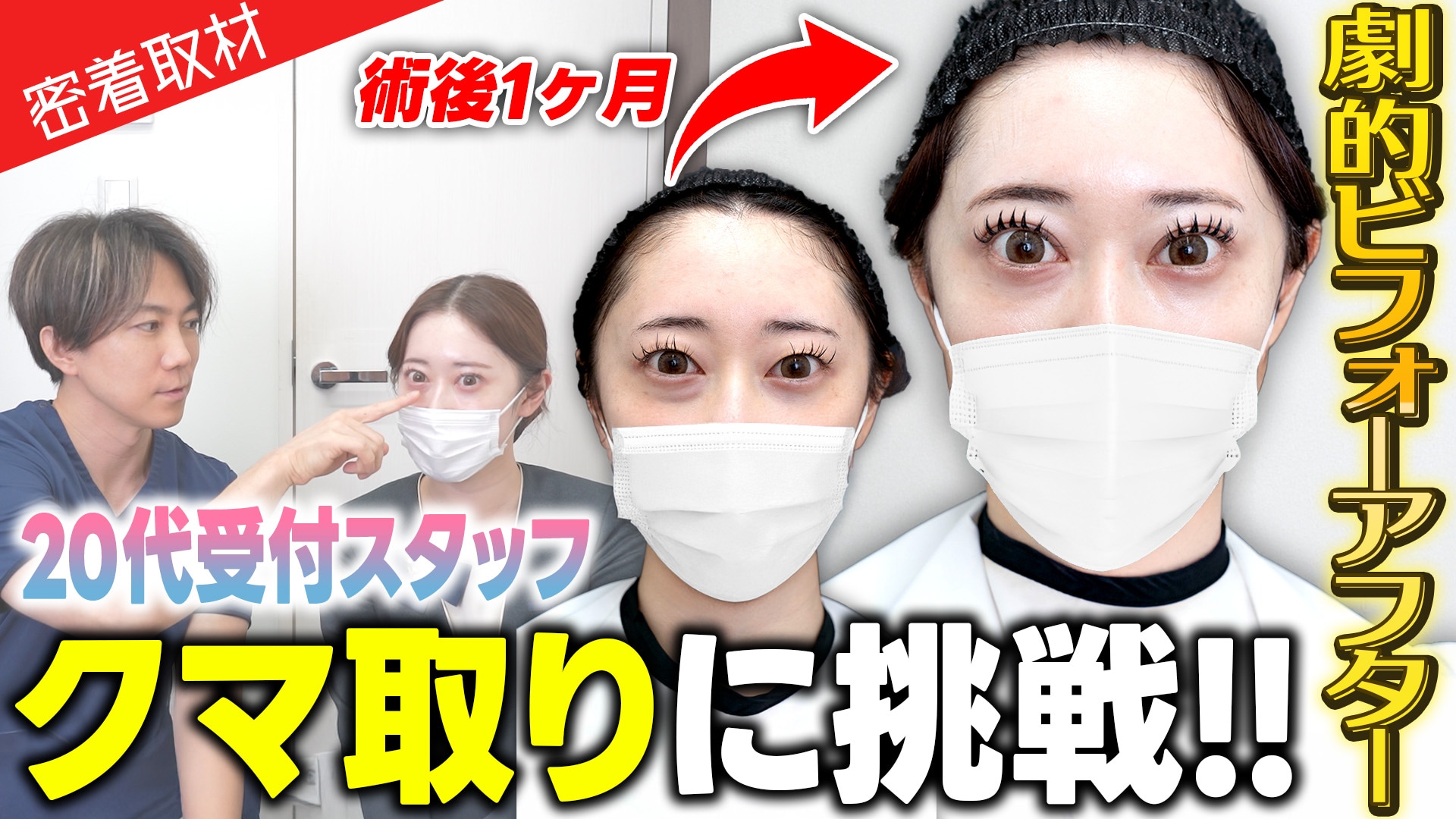 【劇的ビフォーアフター】20代受付スタッフが二重整形とクマ取りに挑戦