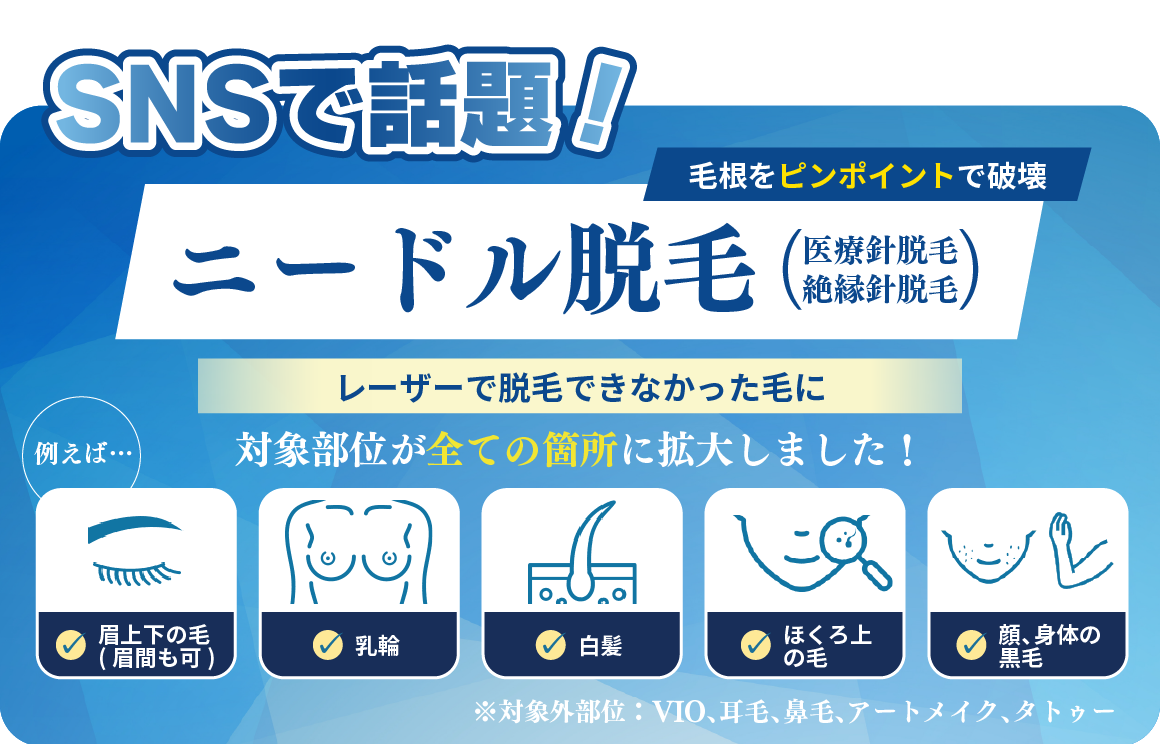 【SNSで話題！】何回脱毛してもなくならない毛に！仕上げのニードル脱毛✨