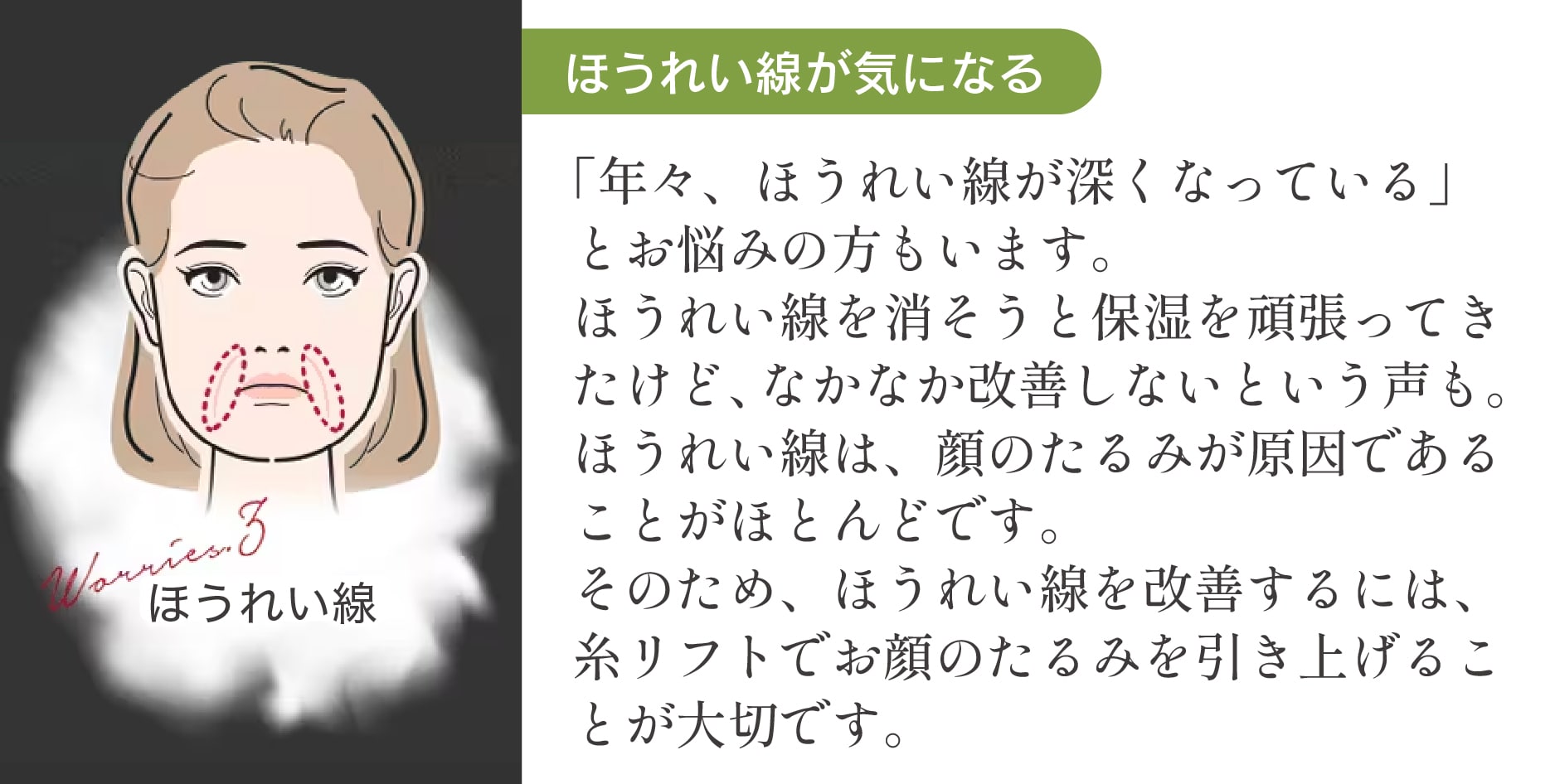 ほうれい線が目立ってくる