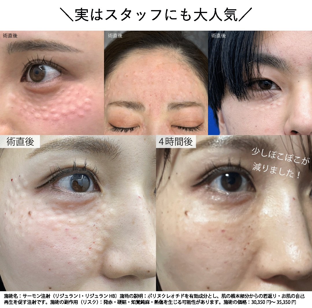 高崎院にて術直後の様子