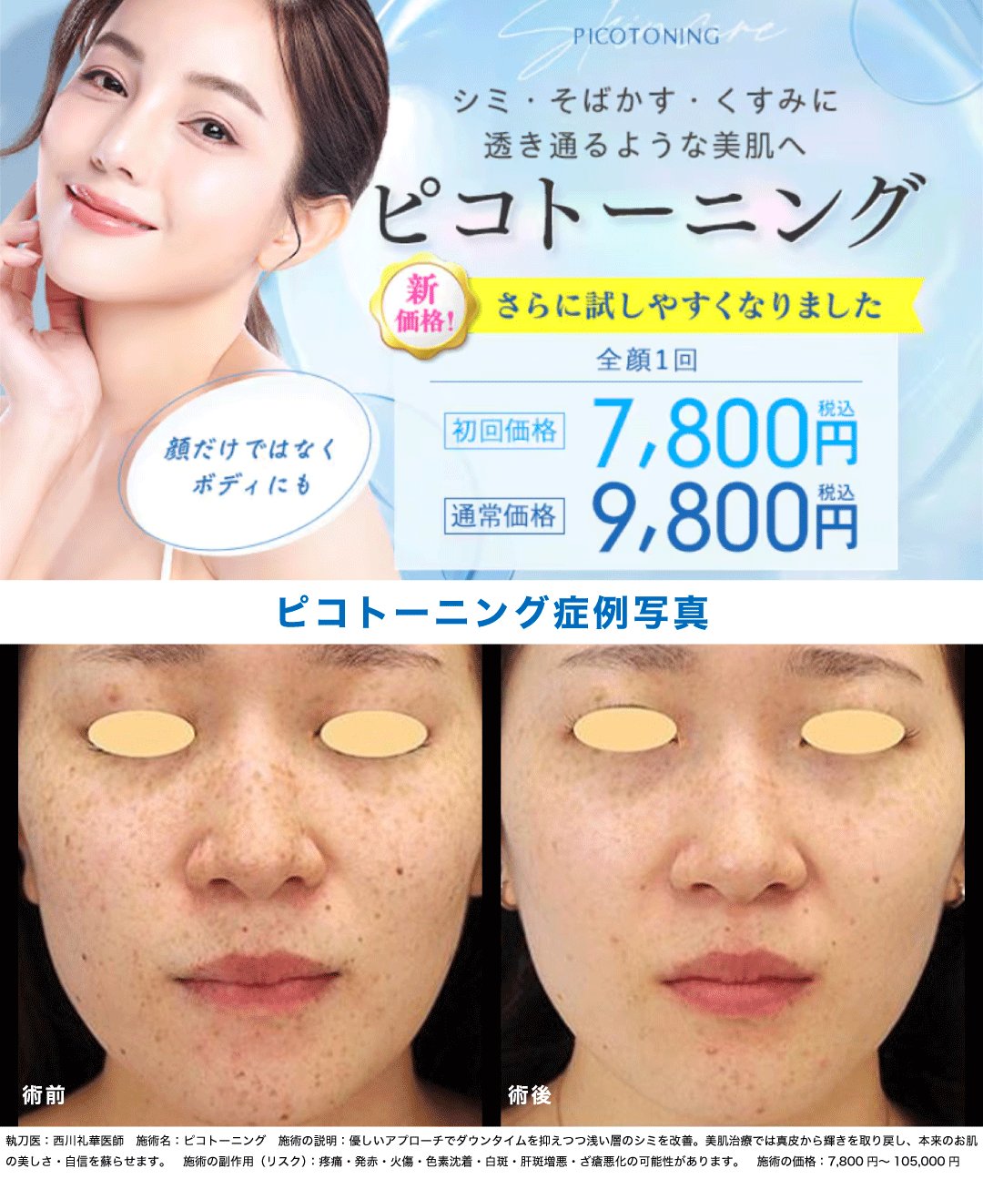 ピコトーニングってどんな効果があるの？