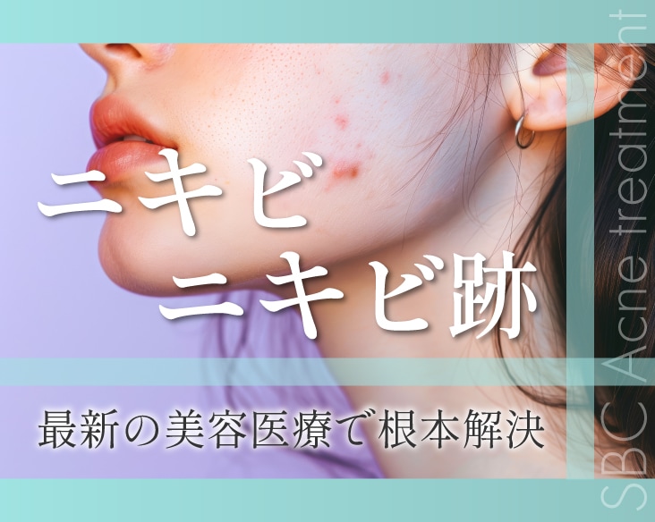【専門治療】群馬 高崎で本気のニキビ・ニキビ跡治療　赤み・クレーターも湘南美容クリニック高崎院で改善