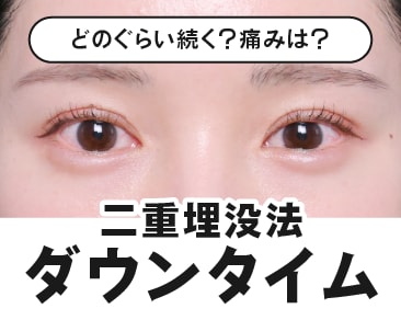 【二重埋没ダウンタイム】二重整形の経過紹介！腫れや内出血について徹底解説！【湘南美容クリニック高崎院】