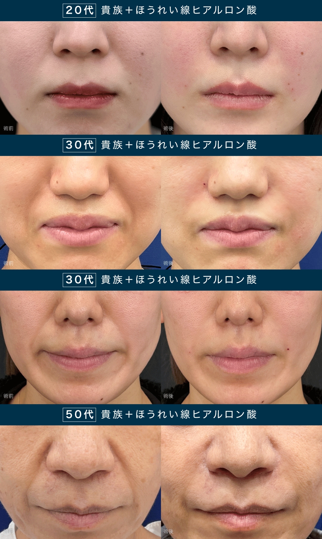 症例写真一覧