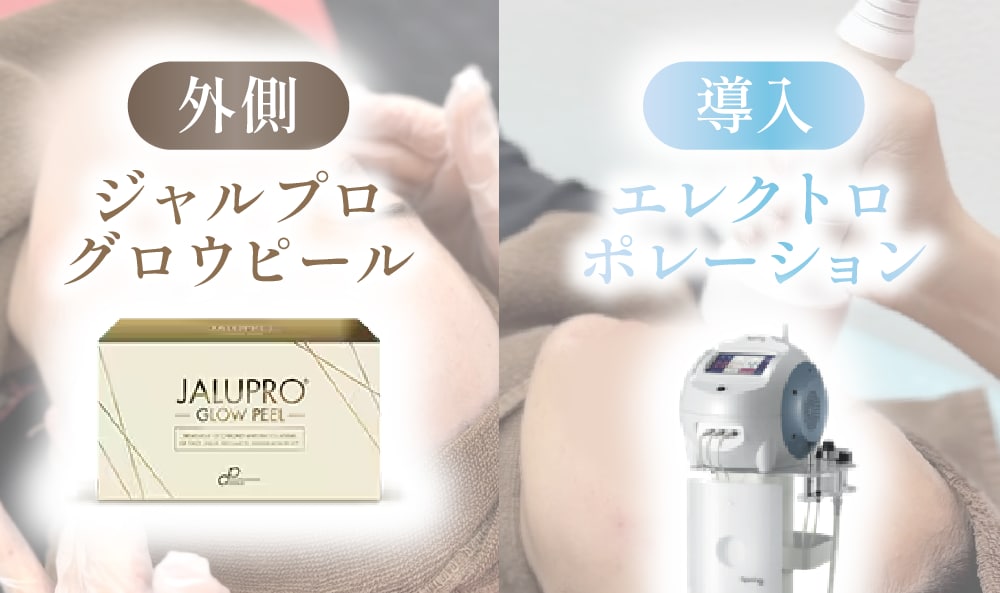 イオン導入（エレクトロポレーション）