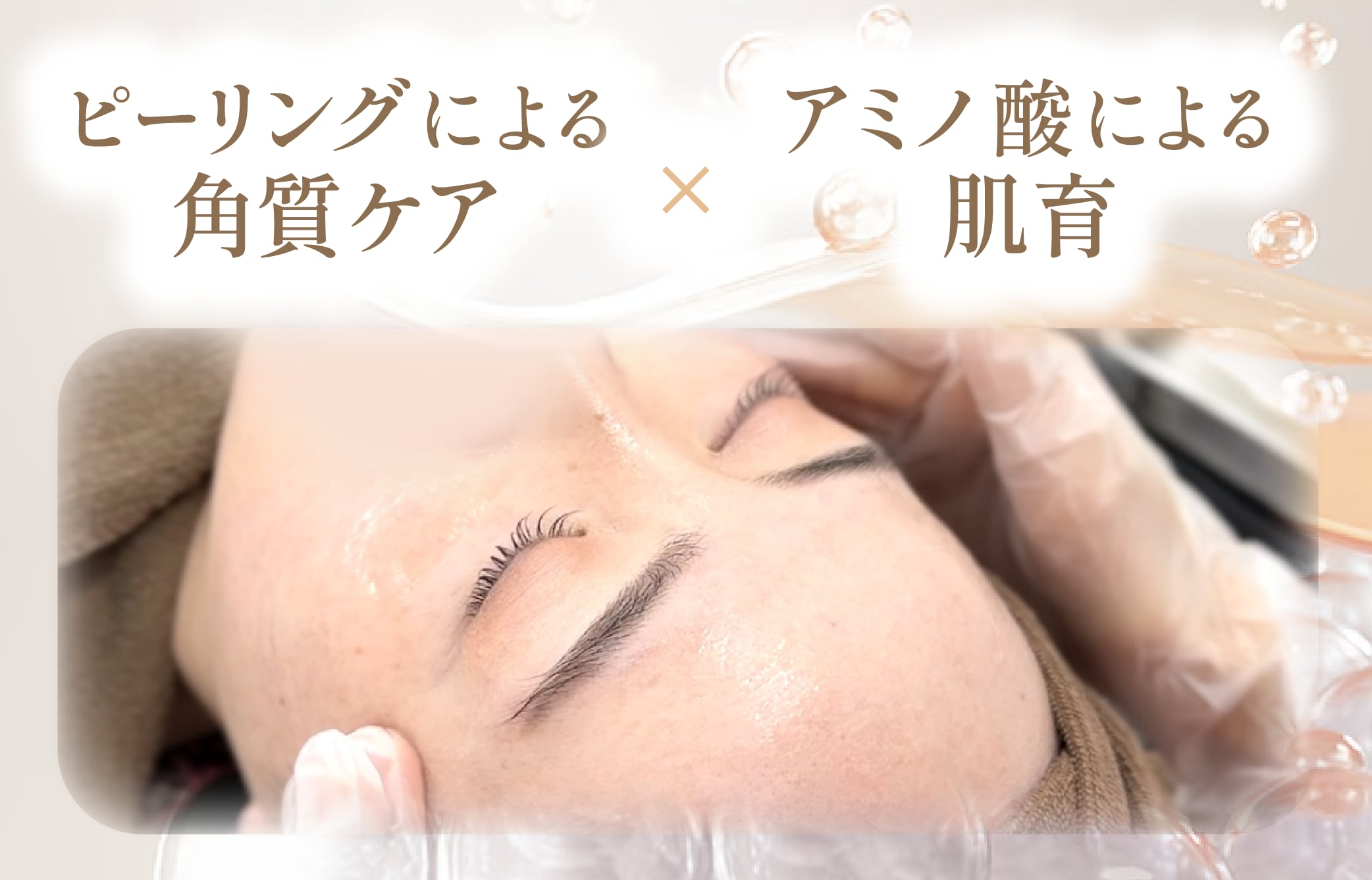 「肌を育む」ピーリング治療