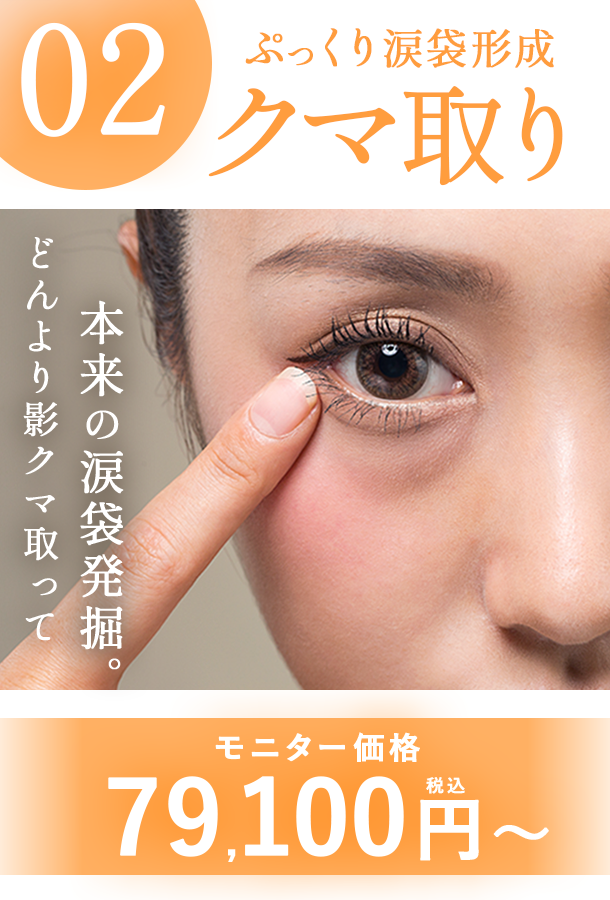 【クマ取り】圧倒的な若返り・印象変化