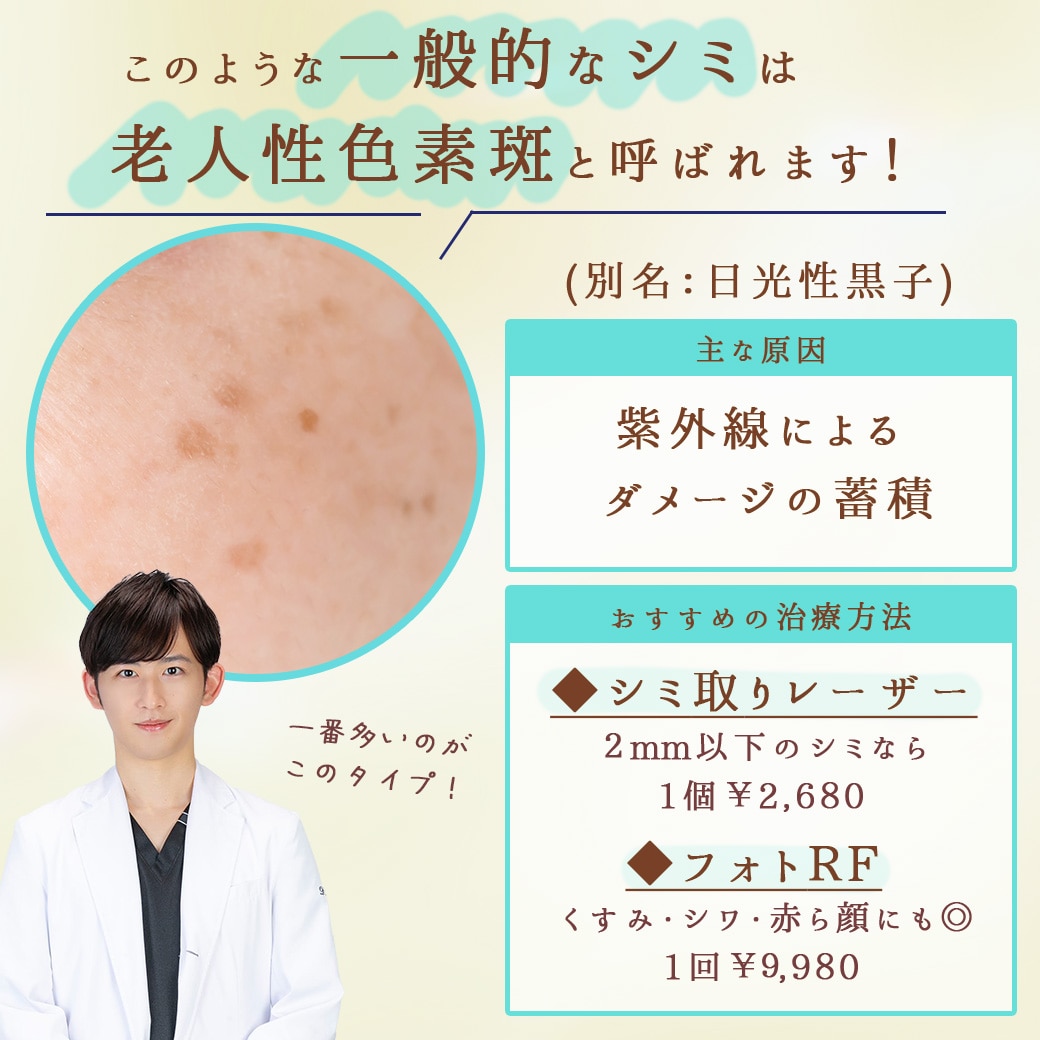 一般的なシミ−老人性色素斑