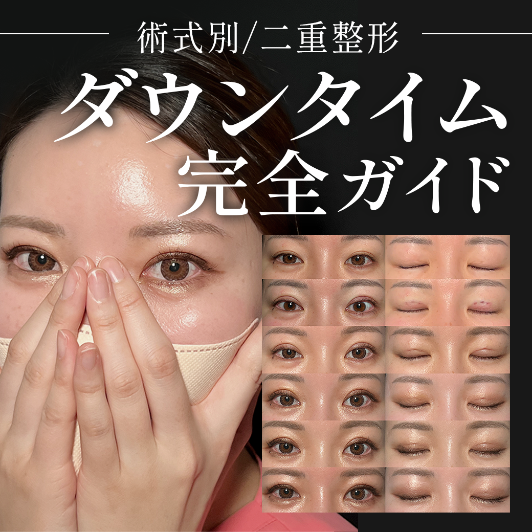 【二重整形ダウンタイム】実際どのくらい腫れるの？術式で差はある？経過を徹底解説します。_埋没二重をするなら湘南美容クリニック所沢院