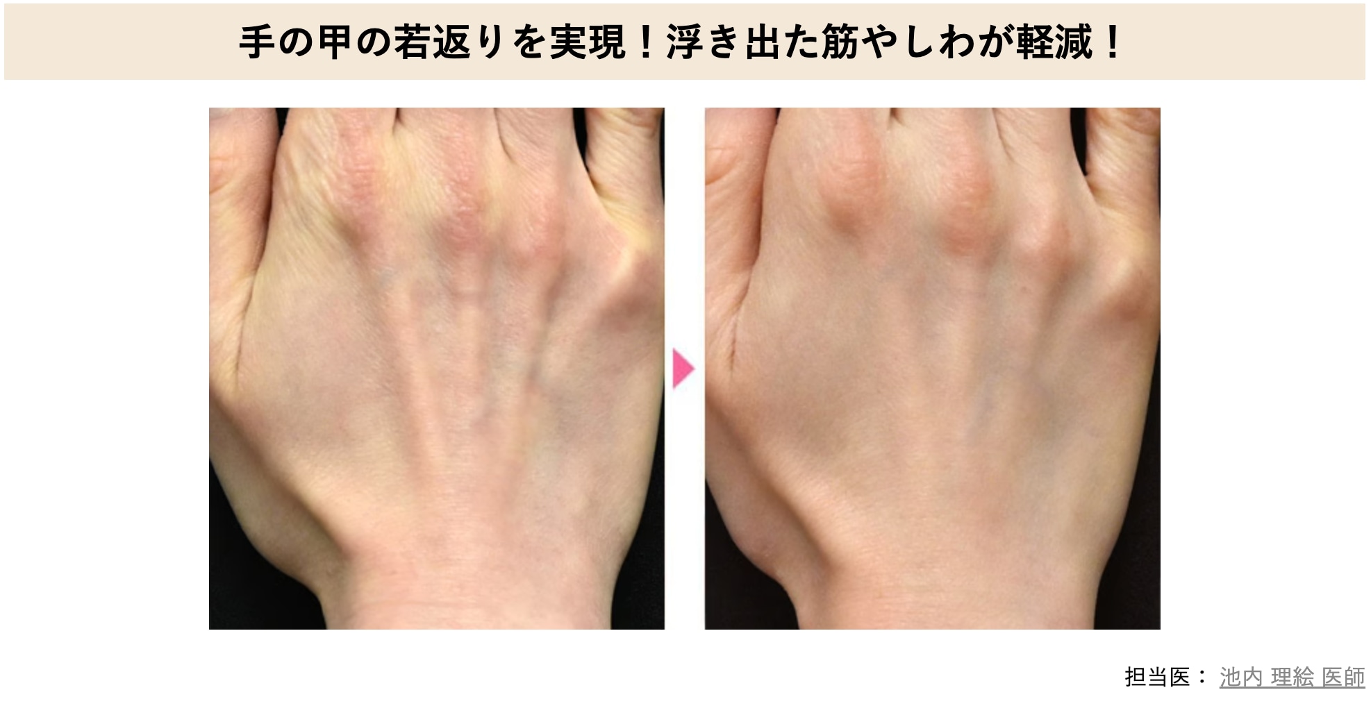 ☑️美容医療が初めてでナチュラル志向の方<br />
☑️自然にバレない範囲で若返りたい方<br />
☑️肌のたるみ・小ジワが気になる方<br />
☑️肌のハリ・うるおいが失われてきたと感じる方<br />
☑️フェイスラインのもたつきが気になる方<br />
