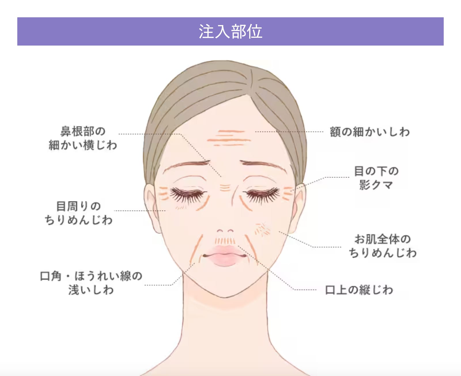 気になる部位にピンポイント注入！