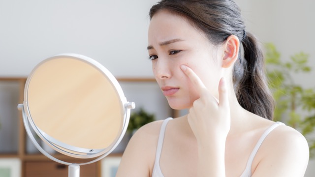 【シミ取り】1個でも個数無制限でも！予算・悩みに合わせてメニューが選べる湘南美容クリニック富山院のシミ取り