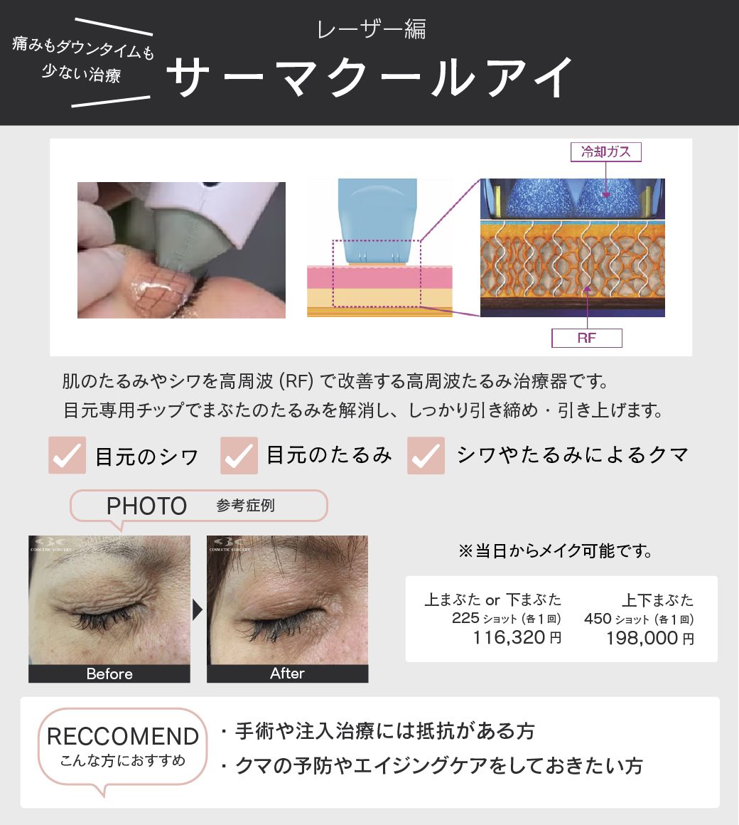 サーマクールアイとは？