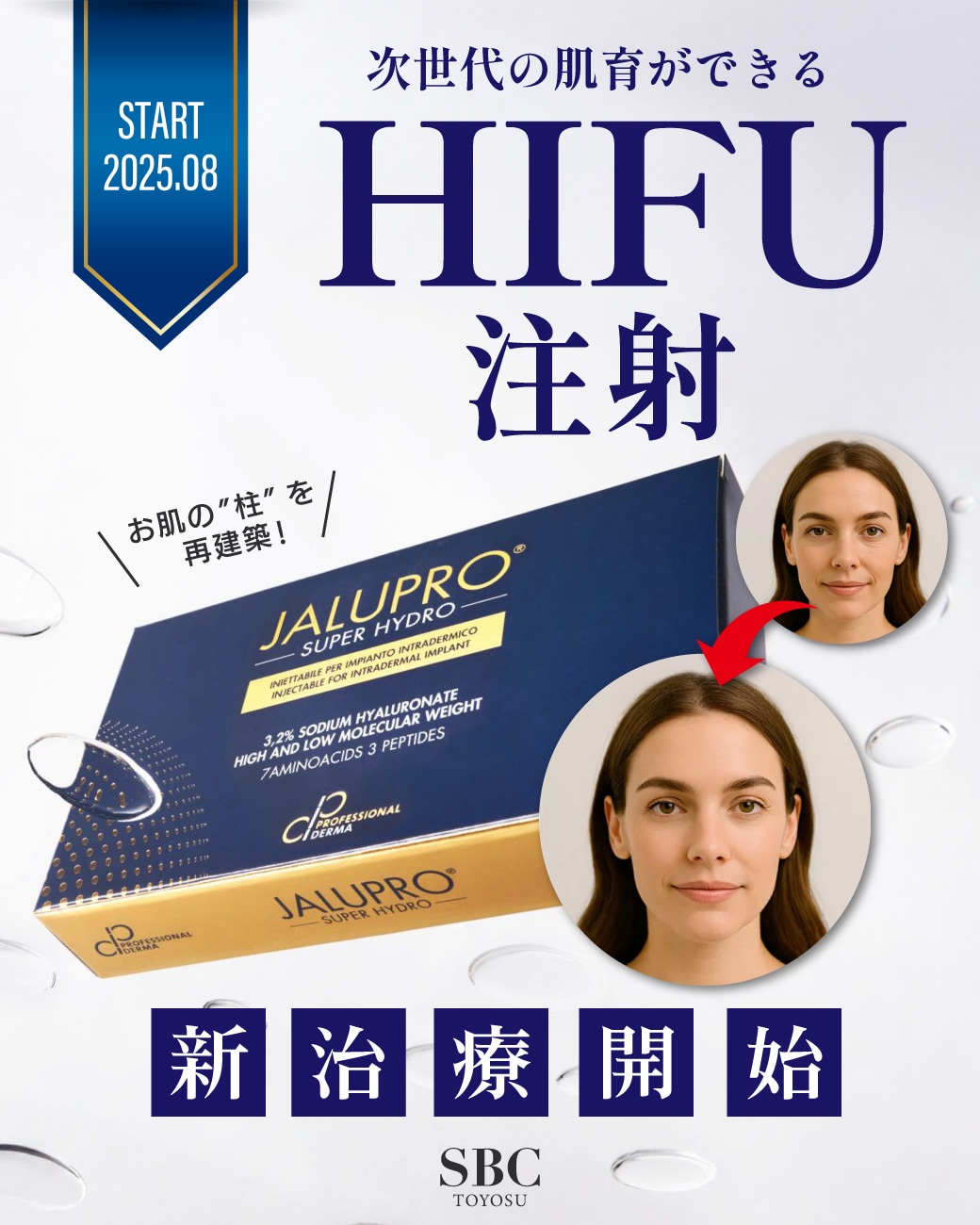 まるでHIFUな肌育注射！「ジャルプロスーパーハイドロ」