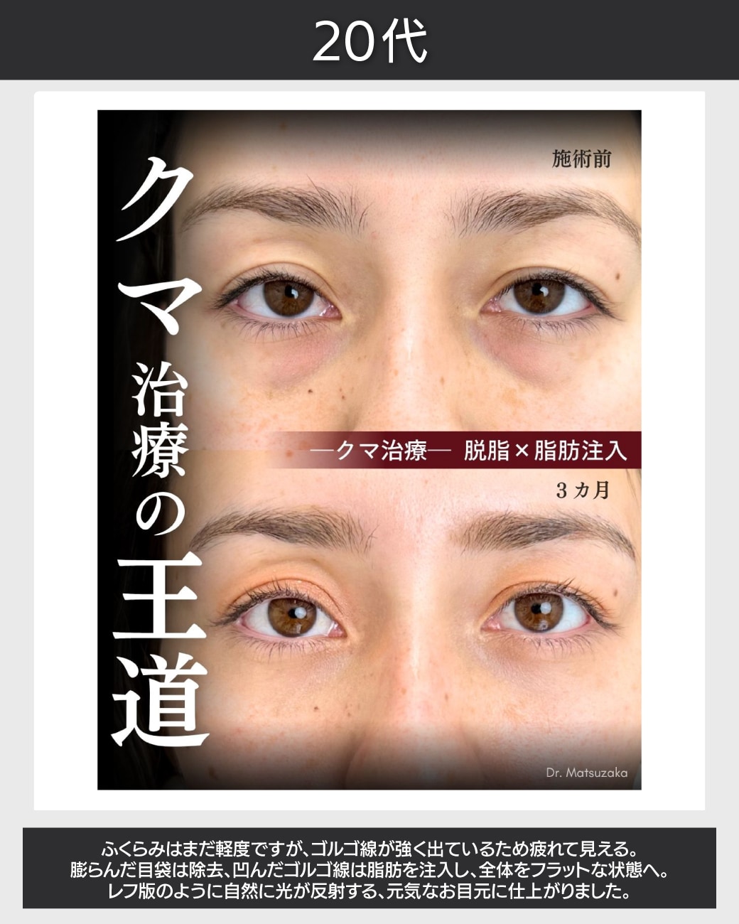 光を反射する