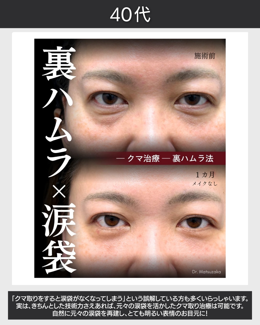 クマと一体化していた