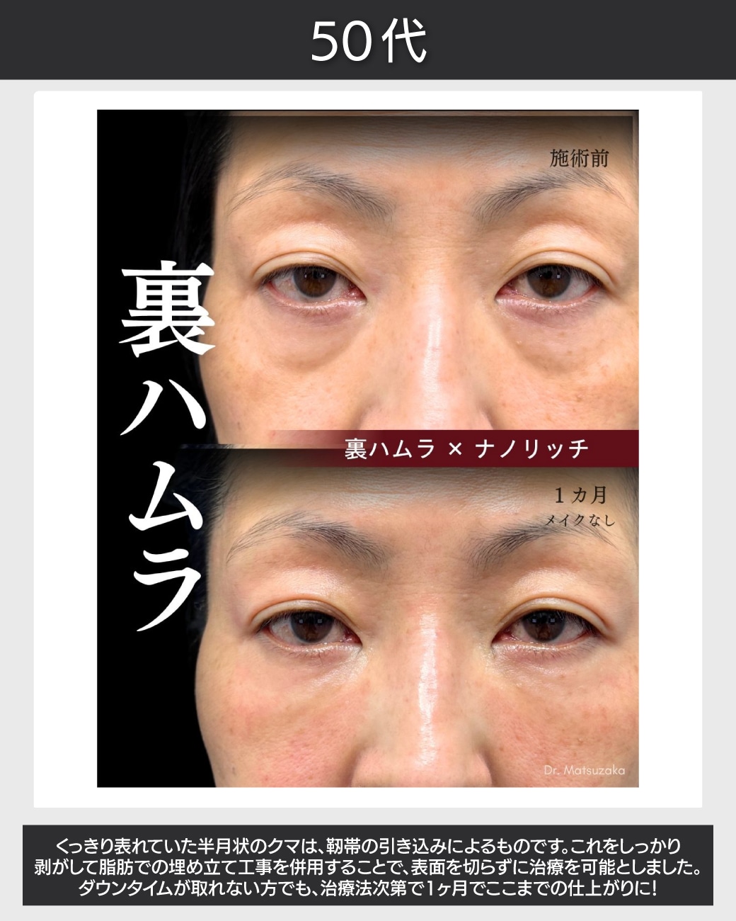 長年酷使して緩んでしまった