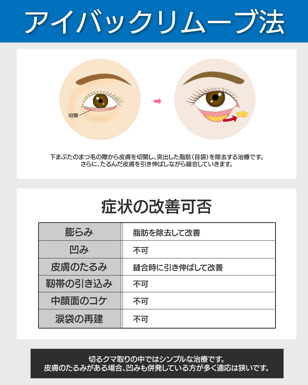 【アイバックリムーブ法】余った皮膚を切除してピンと張りのある目元へ