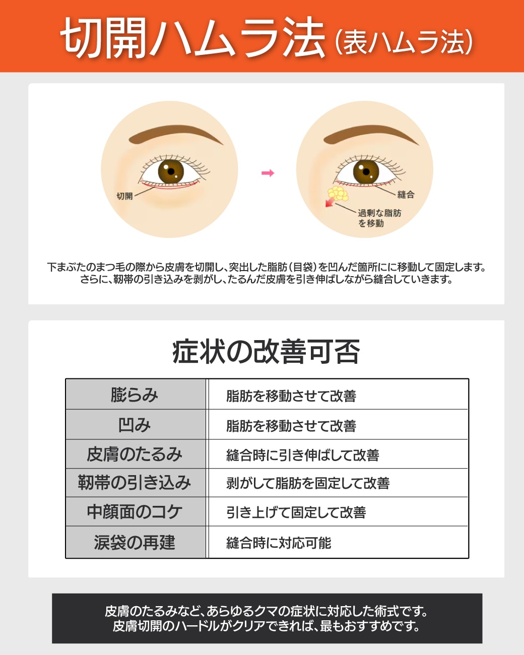 【切開ハムラ法】皮膚のたるみと溝を同時解決。重度のクマを根本から治療