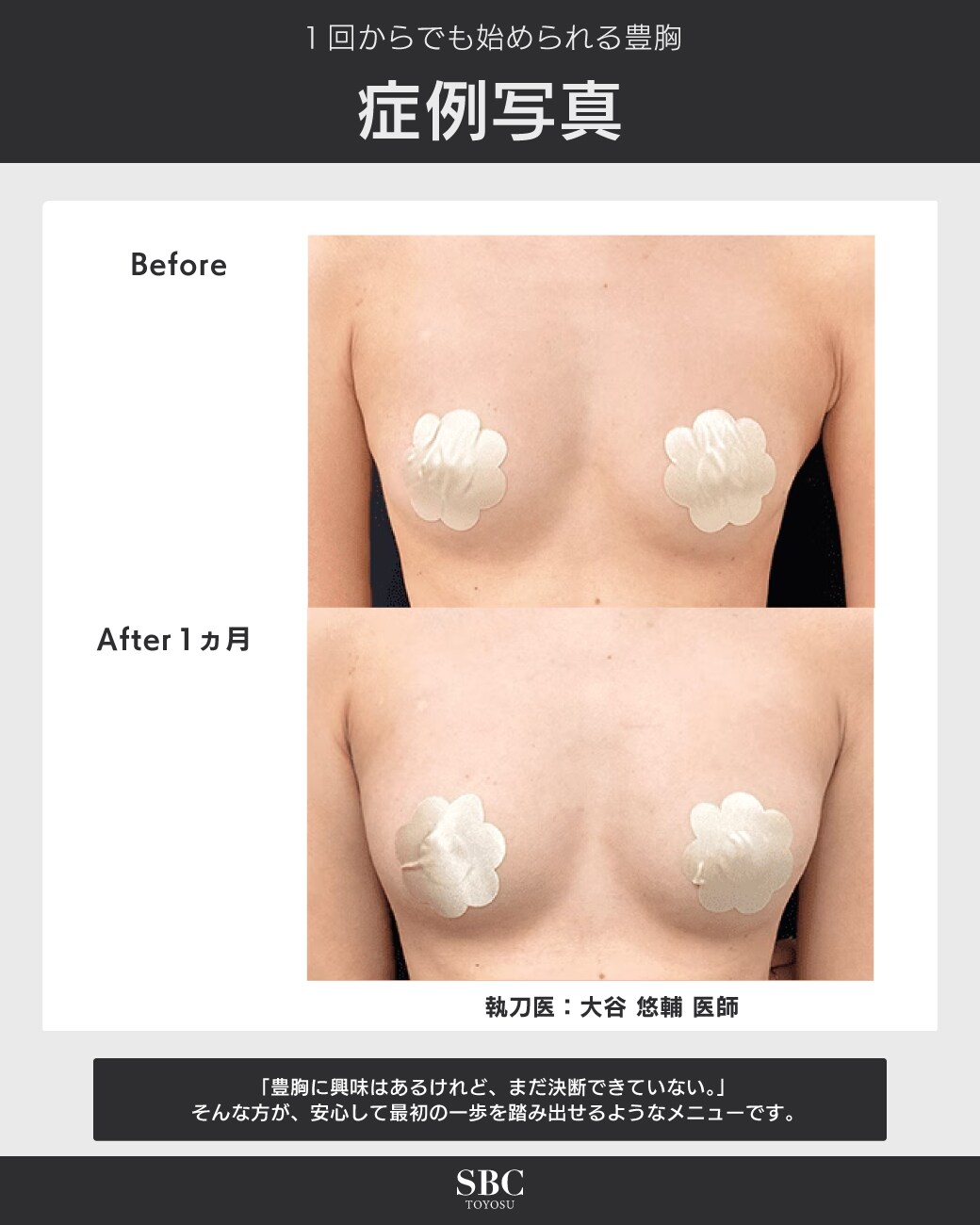 症例写真